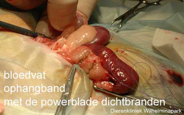 Sterilisatie cavia: de ophangband wordt met een speciale brander dichtgebrand en doorgesneden = de powerblade
